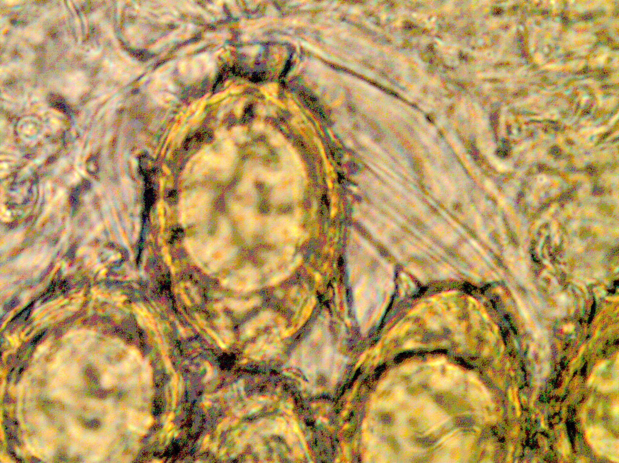 spores uncinatum 3 PH1