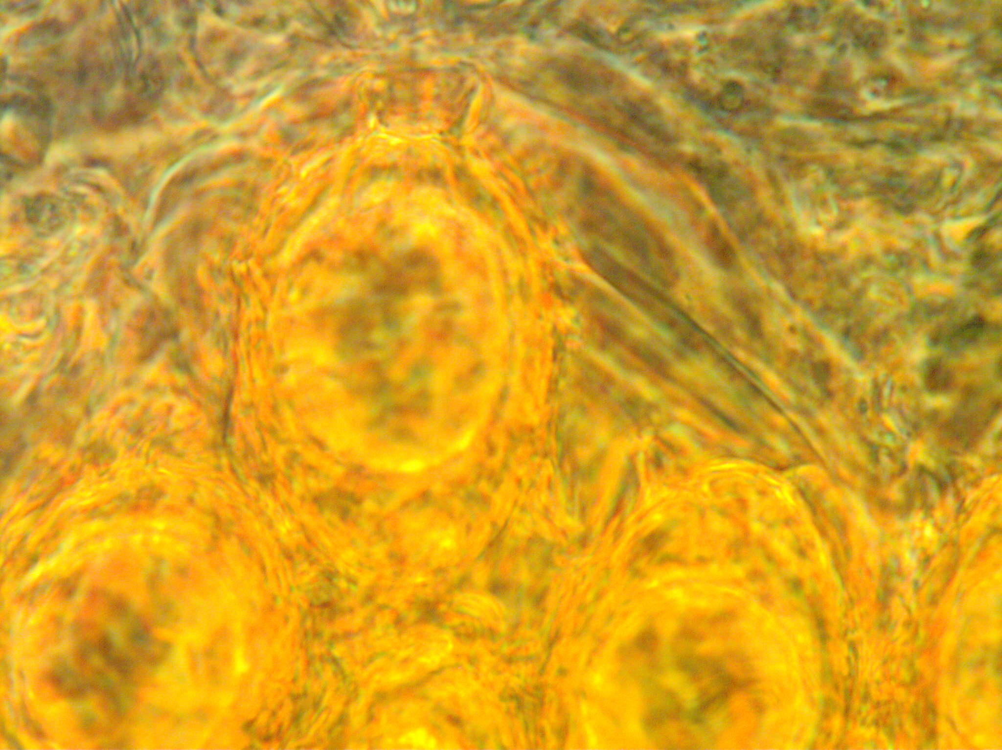 spores uncinatum 5 PH3